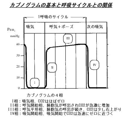 カプノグラム.jpg