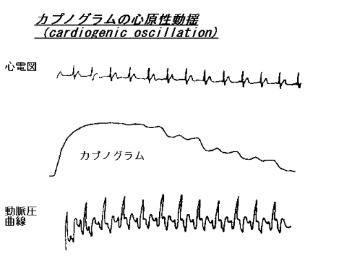 カプノメトリー_2.gif