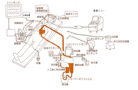 心臓手術.gif