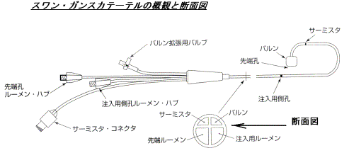 と スワンガンツ は カテーテル