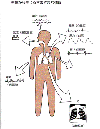 transducer.gif