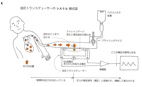 B.P. transducer.gif