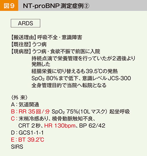 Nt Probnp測定症例 臨床検査概論 ラジオメーターの学術情報サイト Www Acute Care Jp